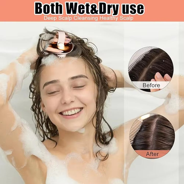 Premium Rechargeable Electric Scalp Massager for Hair Growth, Stress Relief & Headache Relief – Waterproof Handheld Massager