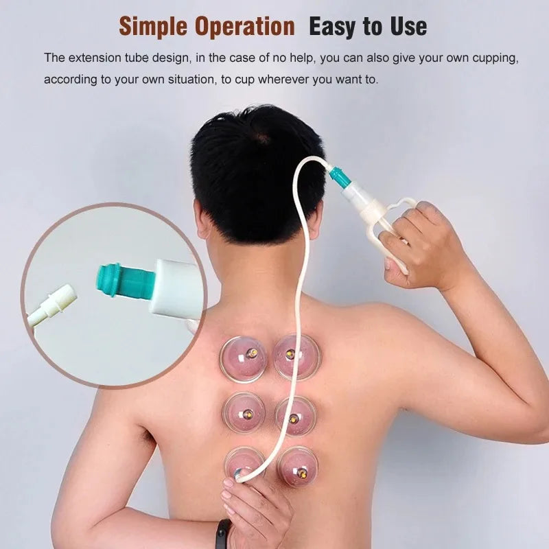 Premium Schröpfen Therapie Set – Professionelle Vakuum-Saugglocken für die traditionelle chinesische Medizin, Physiotherapie, Massage und Muskelentspannung, langlebige Kunststoffbehälter für den Heim- und professionellen Gebrauch