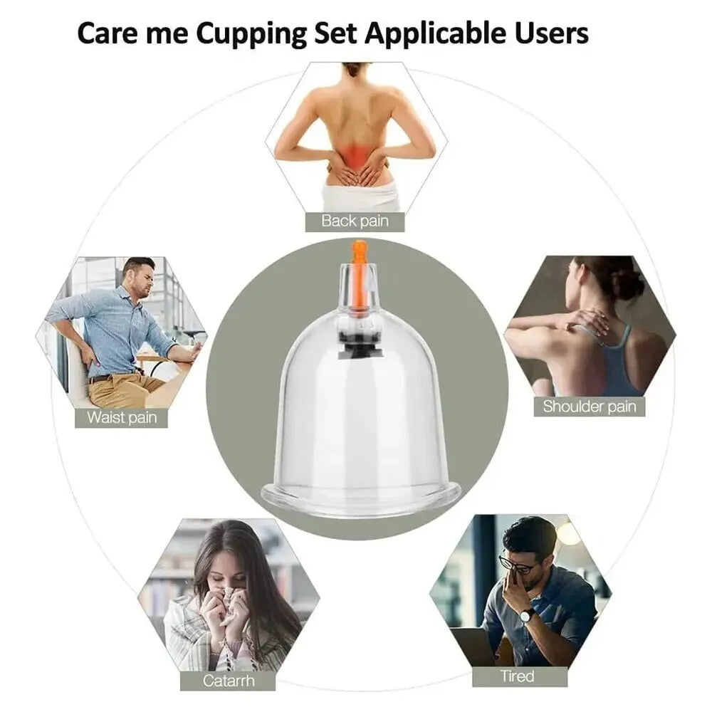 Premium Schröpfen Therapie Set – Professionelle Vakuum-Saugglocken für die traditionelle chinesische Medizin, Physiotherapie, Massage und Muskelentspannung, langlebige Kunststoffbehälter für den Heim- und professionellen Gebrauch